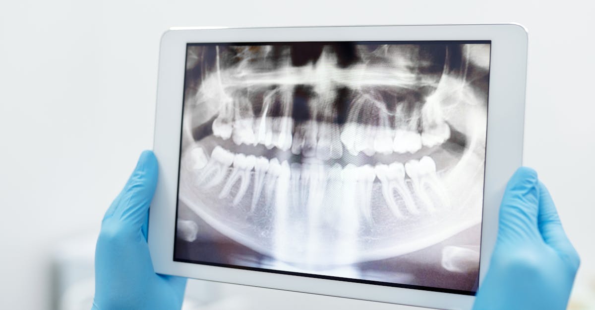 découvrez l'importance des radiographies dans le diagnostic médical. apprenez comment elles permettent d'examiner l'état de santé, de détecter des anomalies et d'améliorer les traitements. informez-vous sur les différents types de radiographies et leur utilité dans le domaine de la santé.